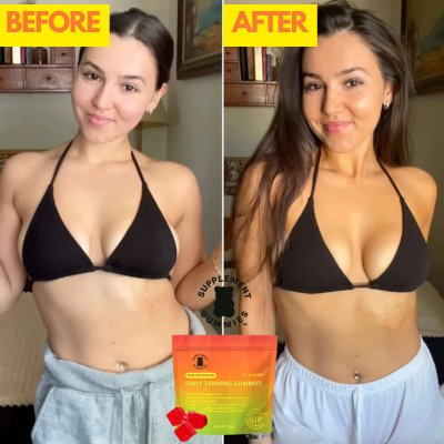 DAILY TANNING GUMMIES - Supplement Gummies™